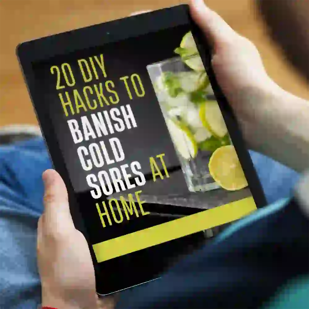 BONUS #1 - 20 DIY Hacks to Banish Cold Sores at Home